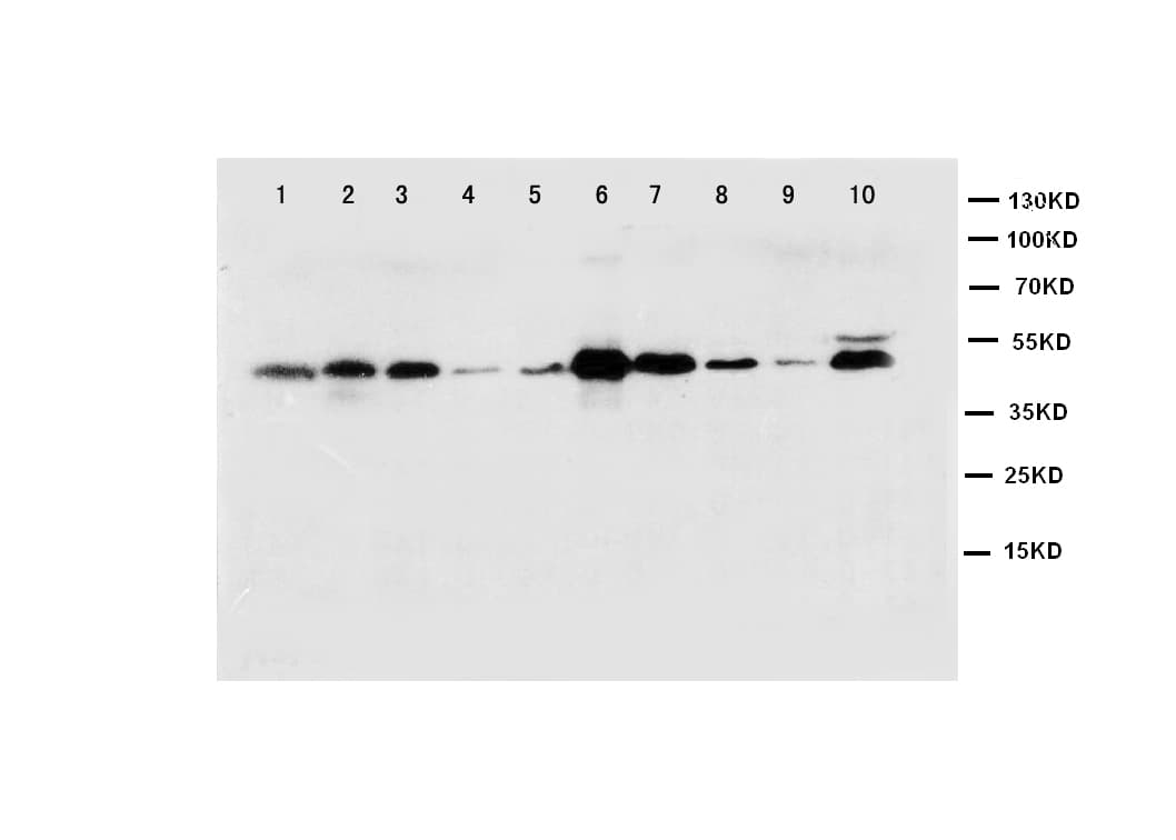 CASP1 / Caspase 1 Antibody (aa249-262)