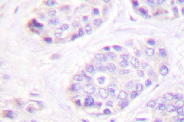 TGFB3 / TGF Beta3 Antibody (Gly292)