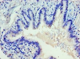 DVL2 / Dishevelled 2 Antibody (aa1-240)