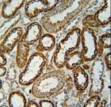 NDUFC2 Antibody (aa90-119)