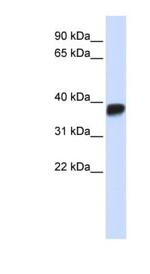 Polyclonal Rabbit anti-Human LDHA / LDH1 Antibody (N-Terminus, IHC, WB)