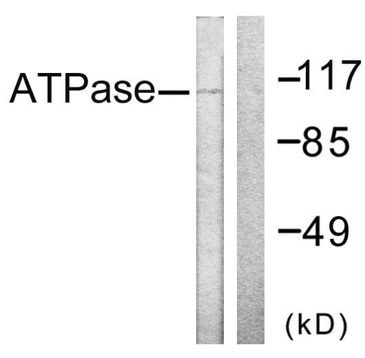 ATP1A1 Antibody (p16)