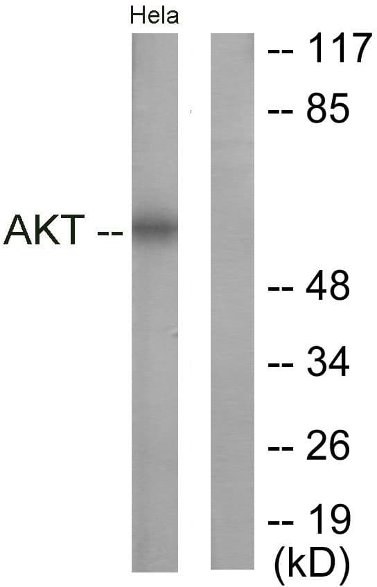 AKT1 Antibody (aa292-341)