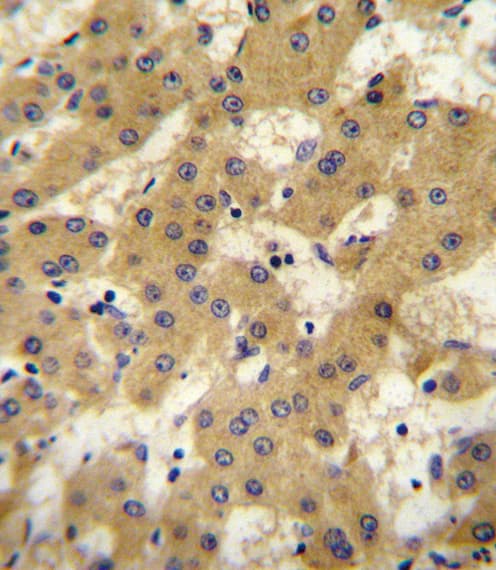 Polyclonal Rabbit anti-Human APOF / Apolipoprotein F Antibody (aa111-138, IHC, WB)