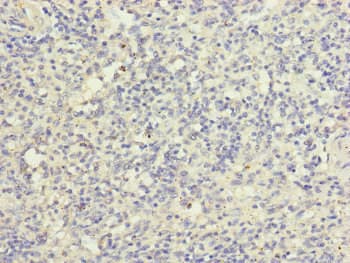 Polyclonal Rabbit anti-Human HK3 / Hexokinase 3 Antibody (IHC)