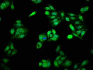 Polyclonal Rabbit anti-Human PSME3 Antibody (IHC, WB)