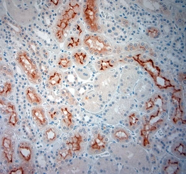 SLC5A8 / AIT Antibody (aa560-610)