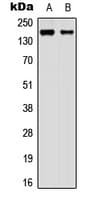 Polyclonal Rabbit anti-Human MAGI2 / AIP-1 Antibody (Internal, IHC, WB)
