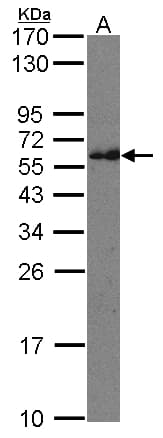 Polyclonal Rabbit anti-Human IFT74 / CCDC2 Antibody (aa538-600, WB)
