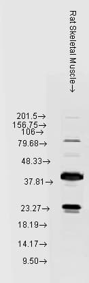 HSPB8 / H11 / HSP22 Antibody