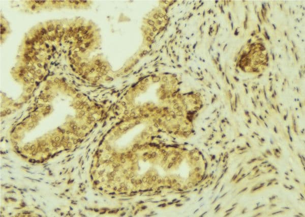 VEGFC Antibody