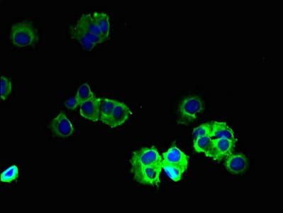 Polyclonal Rabbit anti-Human GABRB2 Antibody (IHC)