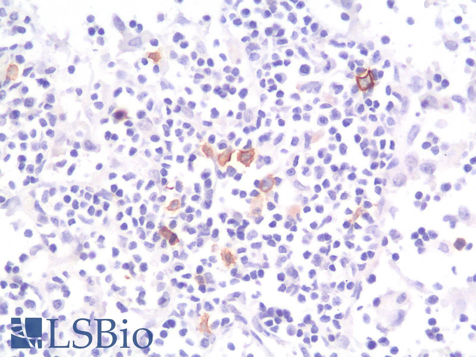 PathPlus™ Recombinant Monoclonal Rabbit anti-Human CD30 Antibody (clone Ki-1/1505R, IHC)