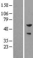 PEA3 / ETV4 Protein (Over-Expression Lysate Myc-DDK (Flag))