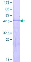Human HOXB7 Protein (Recombinant GST)