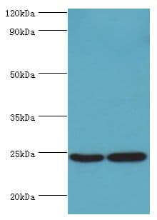 Polyclonal Rabbit anti-Human RAN Antibody (aa1-216, IHC, WB)