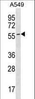 ESAM Antibody (aa259-289)