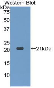 Dermatopontin / DPT Antibody (aa26-197)
