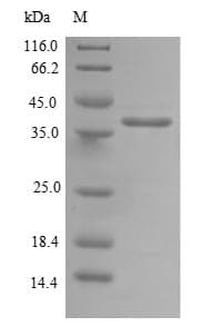 Human DNAJC19 Protein (Recombinant GST, N-terminus)