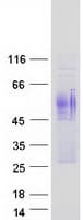 Human ANTXR1 / TEM8 Protein (Recombinant Myc-DDK (Flag))