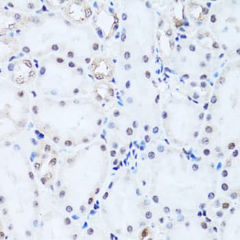 Polyclonal Rabbit anti-Human HIST2H2BE Antibody (IHC, WB)