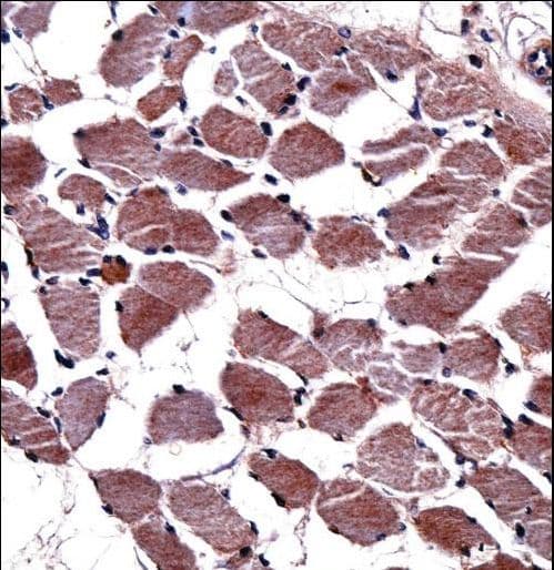 KLK8 / Kallikrein 8 Antibody (aa9-38)