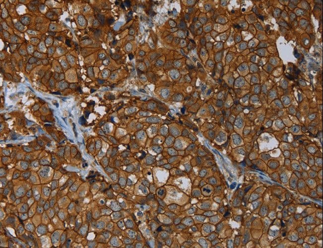 ERBB4 / HER4 Antibody