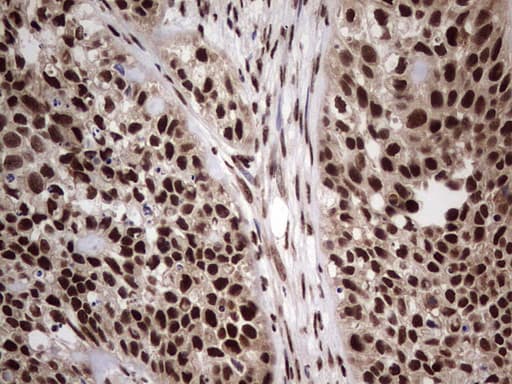 C14orf166 Antibody (clone OTI1E5)