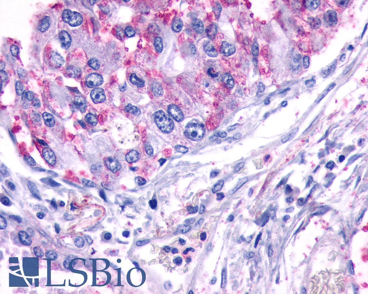 IHC-plus™ Polyclonal Rabbit anti-Human ADGRA2 / GPR124 Antibody (N-Terminus, IHC)