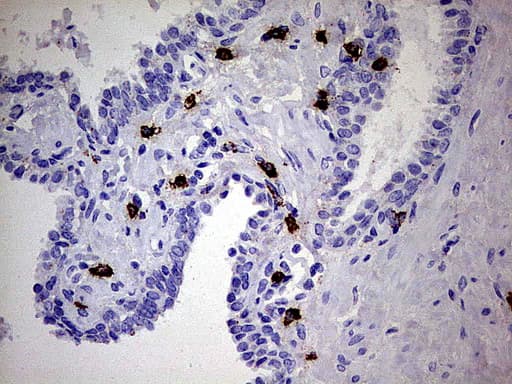 GBA / Glucosidase Beta Acid Antibody (aa40-315, clone UMAB171)