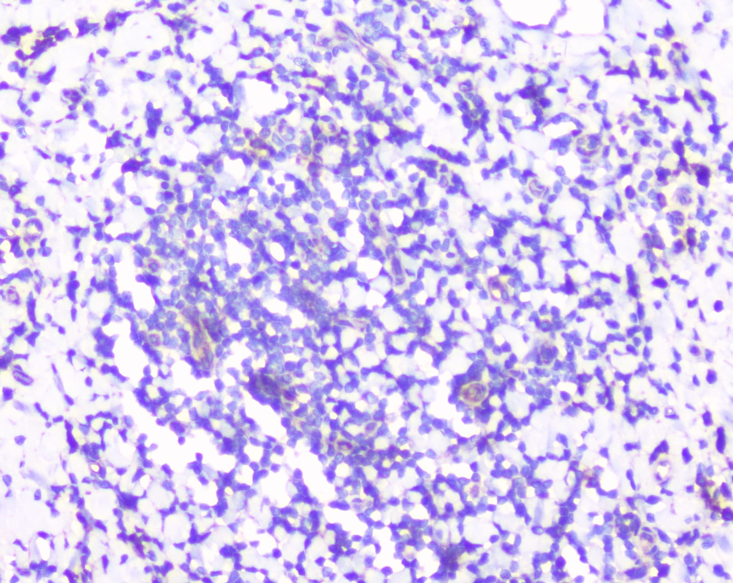 Polyclonal Rabbit anti-Human RPS3 / Ribosomal Protein S3 Antibody (IHC, WB)