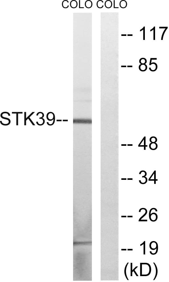 STK39 / SPAK Antibody (aa277-326)