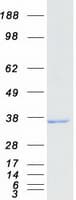 Human RDH11 Protein (Recombinant Myc-DDK (Flag))