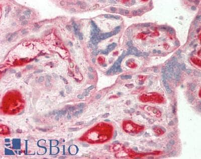 AFM / Afamin Antibody (aa211-403)
