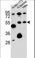 IHC-plus™ SMOC1 Antibody (aa284-313)