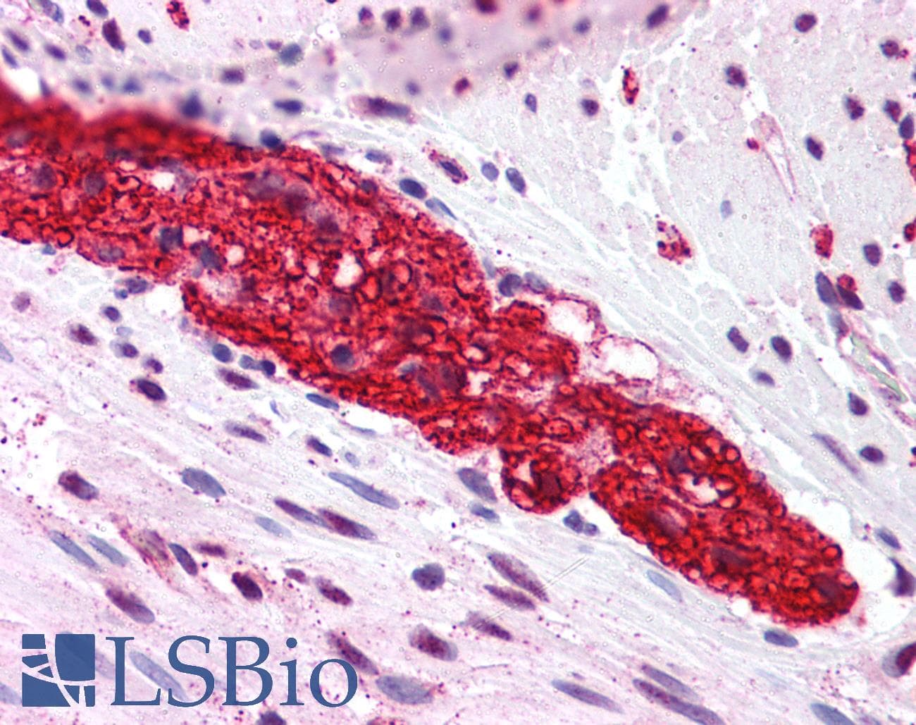 IHC-plus™ GRM5 / MGLUR5 Antibody (N-Terminus)
