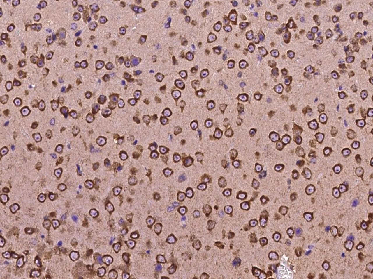 NRP1 / Neuropilin 1 Antibody