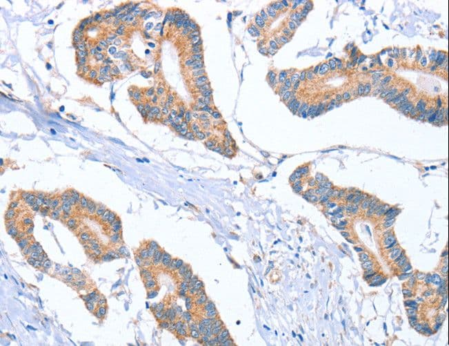 MTMR7 Antibody