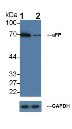 Alpha-Fetoprotein Antibody (aa31-171)