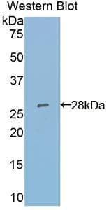 ACTA2 / Smooth Muscle Actin Antibody
