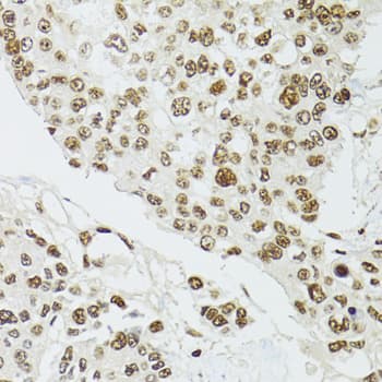 CDX2 Antibody