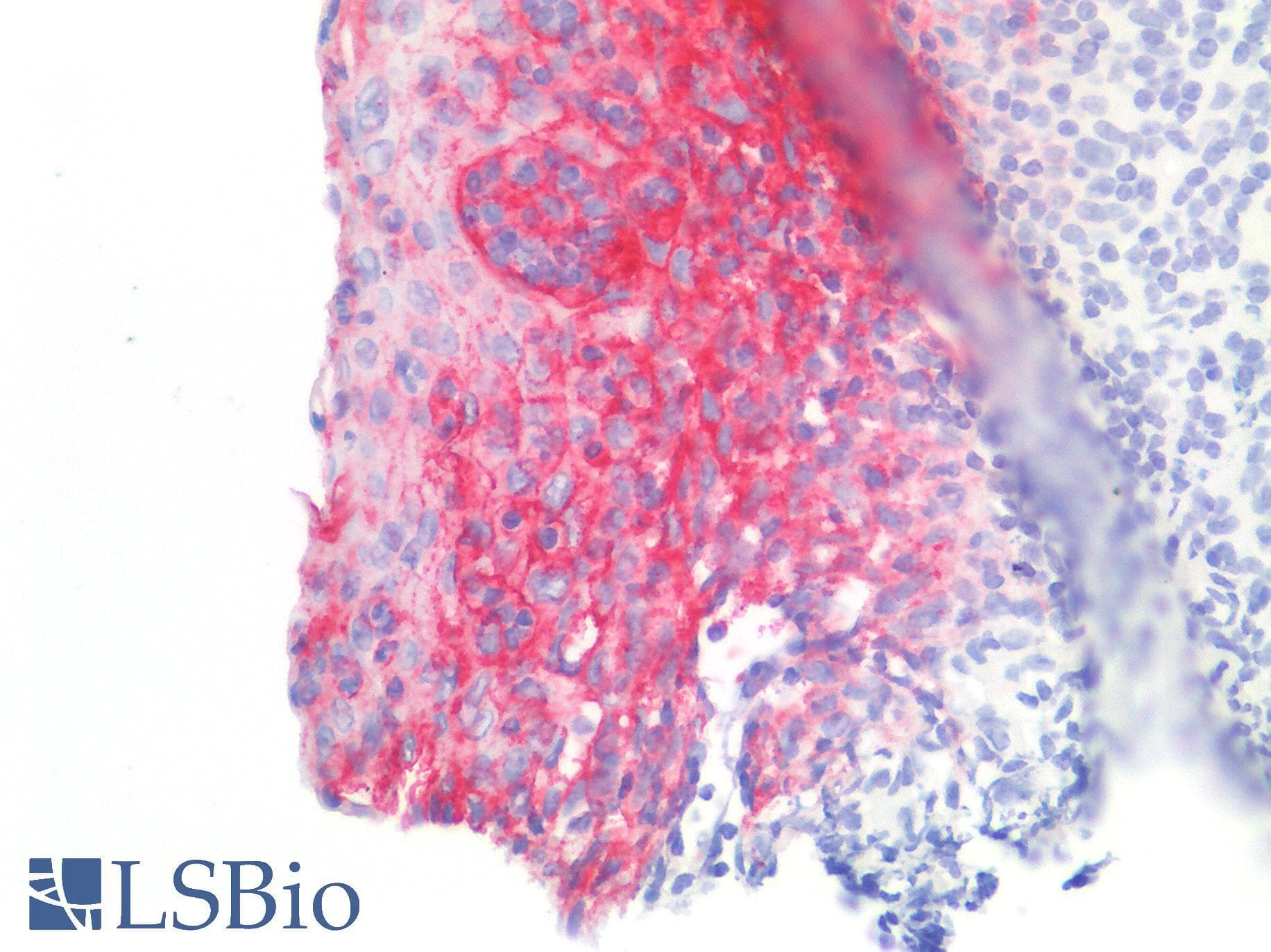 IHC-plus™ CLDN4 / Claudin 4 Antibody (C-Terminus)