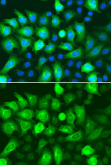 Polyclonal Rabbit anti-Human RRM2 Antibody (IHC, IF, WB)