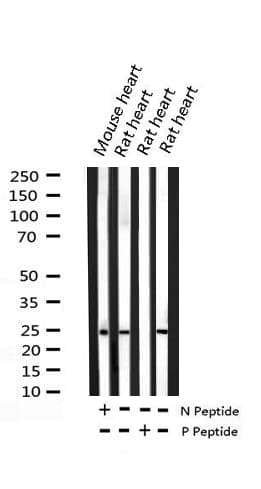 Polyclonal Rabbit anti-Human TNNI3 / Cardiac Troponin I Antibody (phospho-Ser43, IHC, WB)