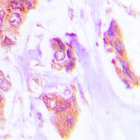 CTF1 / Cardiotrophin-1 Antibody (N-Terminus)