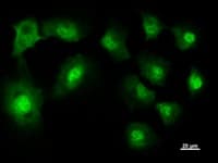 NARS Antibody (clone NARS2G5)