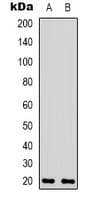 Polyclonal Rabbit anti-Human BAX Antibody (C-Terminus, IF, WB)