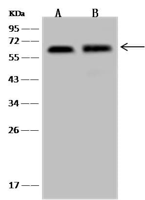 NAG20 / UBAP1 Antibody
