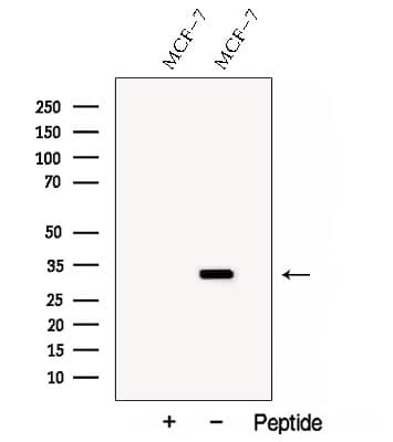 Polyclonal Rabbit anti-Human SARNP / Hcc-1 / CIP29 Antibody (IF, WB)