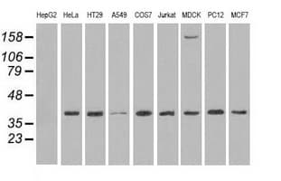 MAPK1 / ERK2 Antibody (clone OTI6F8)